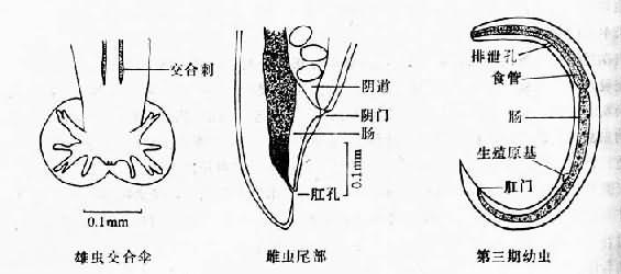 广州管圆线虫