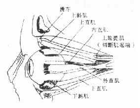 眼外肌之起端及止端图解(左眼)